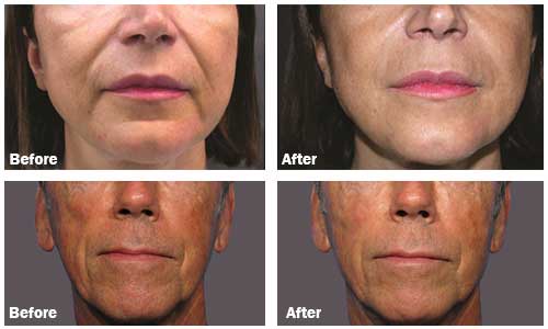 Prp Vampire Facial logo