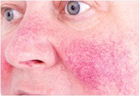 Celebrity Dermatologist- Susan Bard, M.D. logo