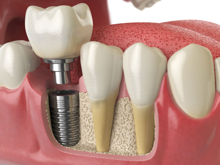 California Dental Group Upland logo
